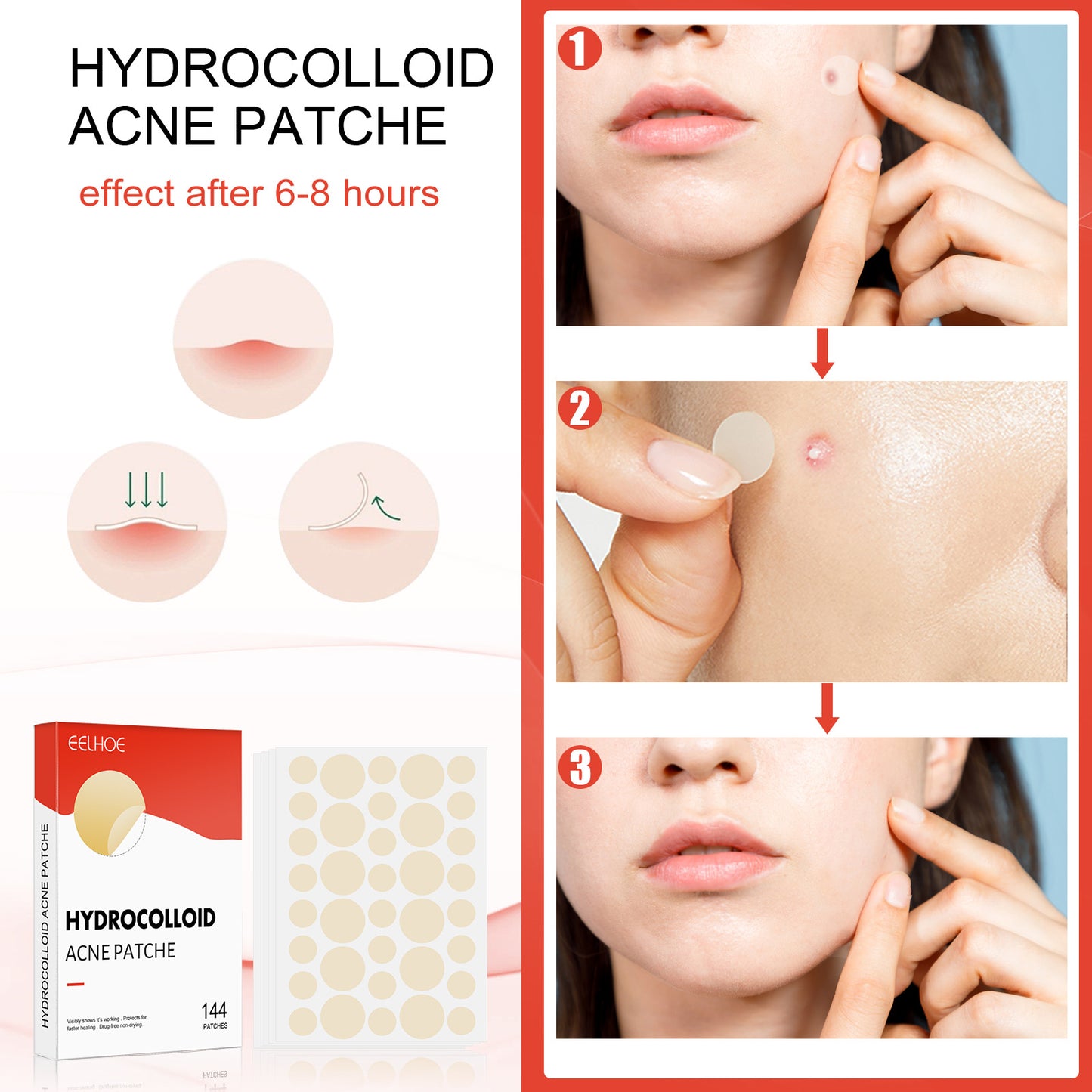 EELHOE Hydrocolloid Acne Patch Invisible Makeup Closed Acne Patch Cleansing Acne Waterproof Breathable Acne Muscle Repair Patch